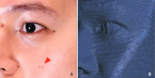 Figure 4. A, A single composite image derived from three images (front, right, and left)