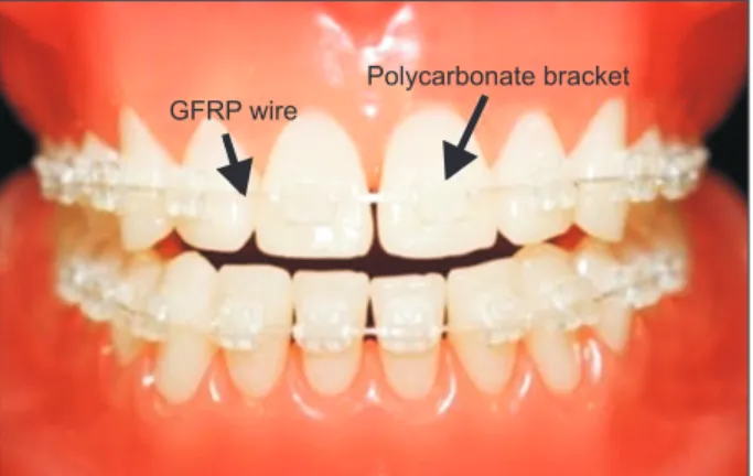 Figure 1. Photograph of esthetic glass-fiber-reinforced  plastic (GFRP) orthodontic archwires