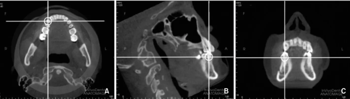 Figure 1. The cone-beam com puted tomography image of the craniofacial region using InvivoDental 5.1 software
