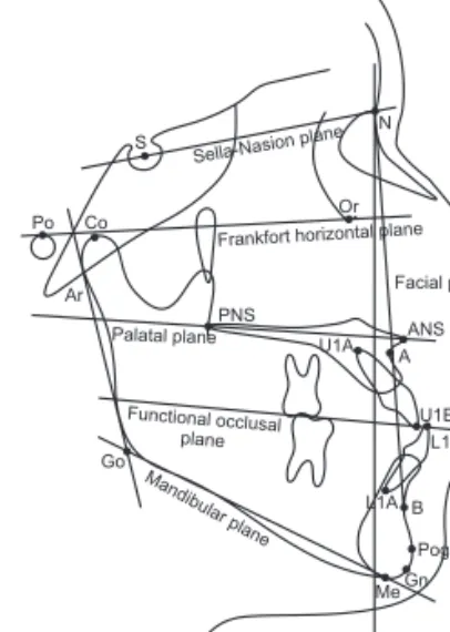 Figure 1. Landmarks and reference planes. S, Sella; 