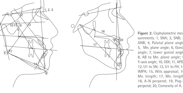 Figure 2. Cephalometric mea- mea-surements. 1, SNA; 2, SNB; 3,  ANB; 4, Palatal plane an gle; 