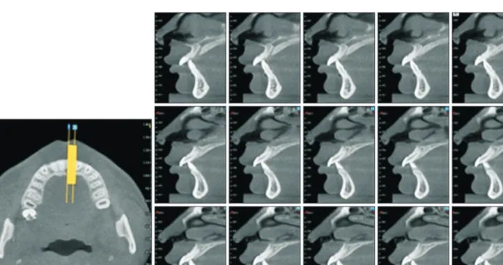 Figure 1. Three-dimensional reconstructions of cross-sectional and sagittal slices.