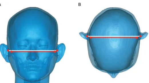 Figure 1. Parallelism of the skeletal and soft-tissue poria . A, Vertical parallelism; B, anteroposterior parallelism