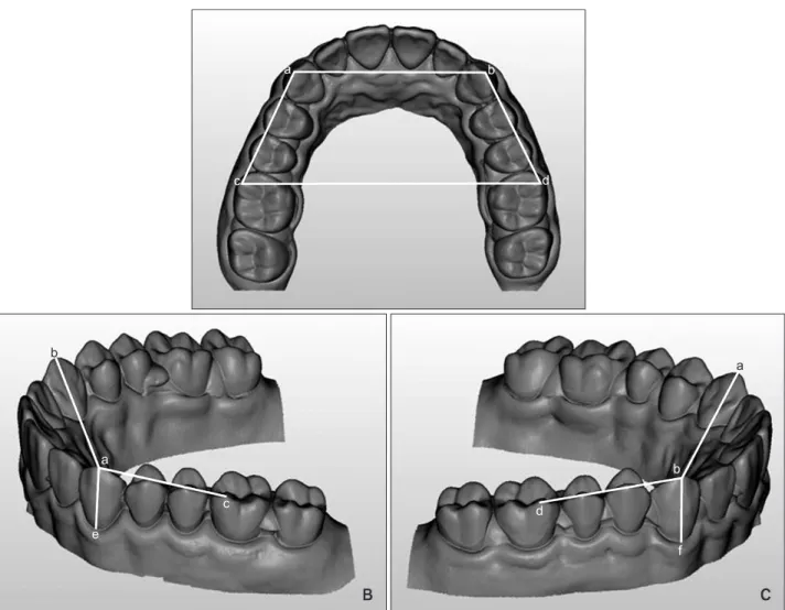 Figure 1. Reference points and linear measurements on the upper full arch model. A, Upper view; B, oblique view from  the right side; C, oblique view from left side