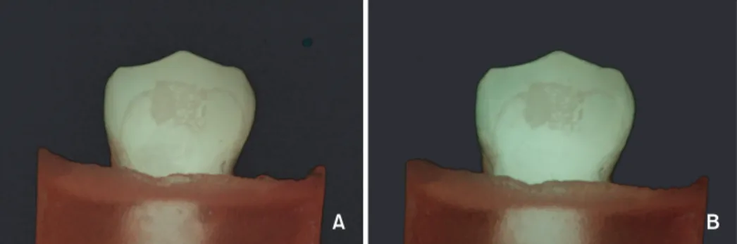 Figure 1. Representative light-induced fluorescent images of the control group. Pretreatment (A) and post-treatment (B).