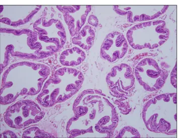 Fig. 1. Prostate section of control group. There is no evidence of chronic  inflammatory cell infiltration, acinar change and interstitial fibrosis  (H&amp;E stain, ×100)