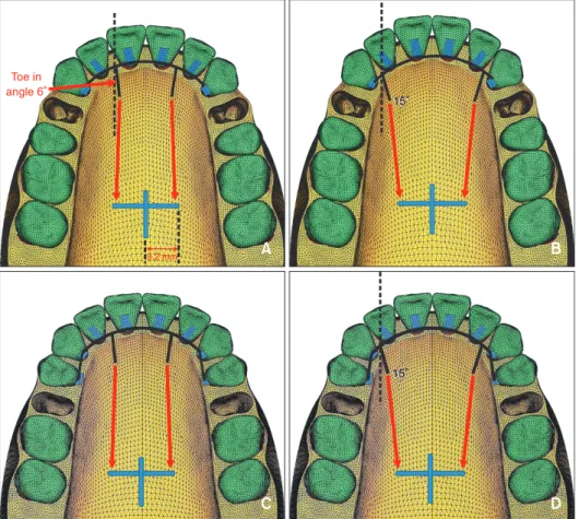 Table 1. The mechanical properties of the materials used  for each tissue type in the study