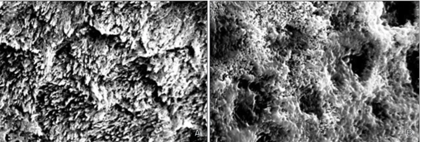 Figure 2. Scanning electron microscopy images of acid-etched enamel tooth surfaces. A, Surface of a tooth etched with  35% phosphoric acid (×5,000)