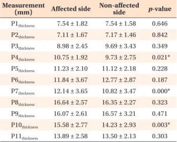 Table 3. Results of the CBCT analysis of the soft-tissue  thickness at the intersecting points