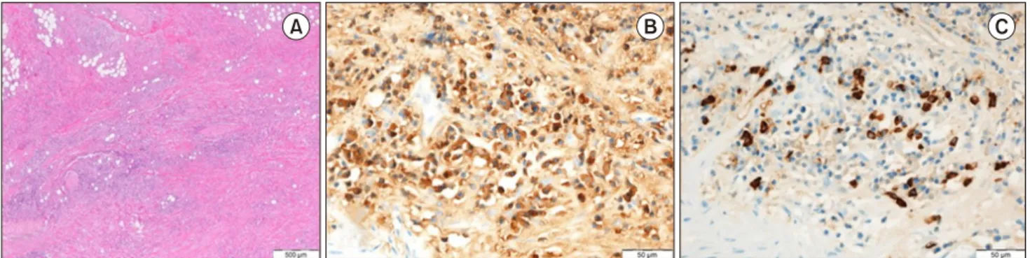 Fig. 3. (A) A low-power histologic image of a hematoxylin and eosin–stained section of periaortic soft tissue