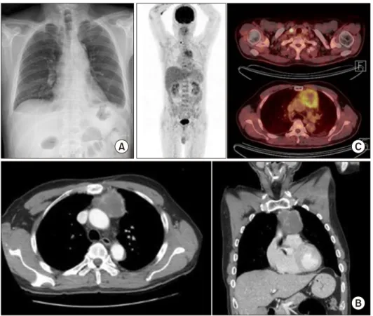 Fig. 1. Imaging studies of the chest. 