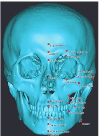 Figure 1. Method used for the three-demensional com- com-puted tomography-image recon struction.
