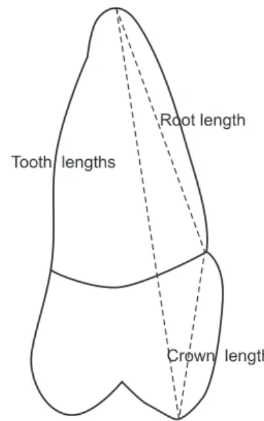 Figure 1. Schematic of the landmarks used for measuring  the total tooth, crown, and root lengths of the extracted  premolars.