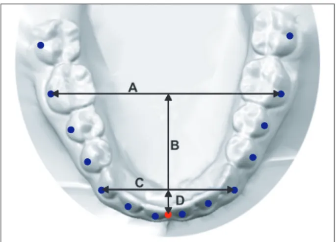Figure  4.  Frequency  distributions  of  the  arch  forms  according to Angle’s classification of malocclusion and  ethnicity