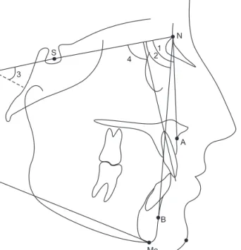 Figure 2. Landmarks and linear measurement on postero- postero-anterior  radiograph.  Maxillary-maxillary  apical  base  width (Mxr–Mxl) was defined as the horizontal distance  between the right and left intersections of the lateral  contour of the maxilla