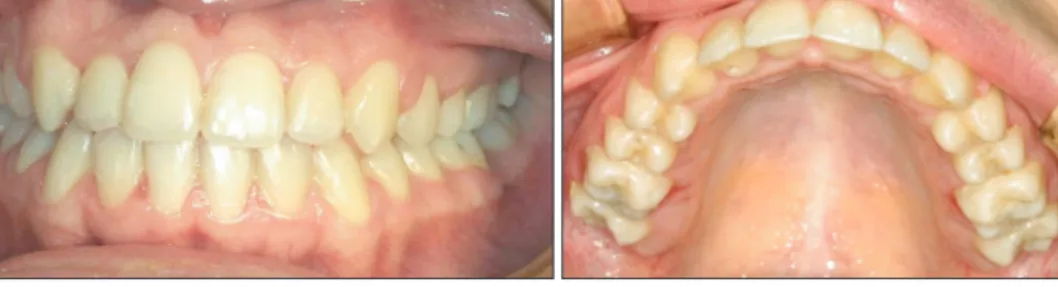 Figure 7. Post-treatment pho- pho-to gra phs.