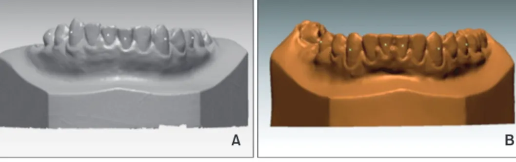 Figure 12. The dentition extracted from the superimposed image. A, Combined image, B, dentition was extracted.