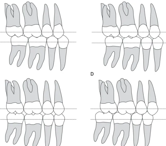 Figure 2. Sectioned images of 3-dimensional digital models showing the buccal and lingual surfaces of the first molars
