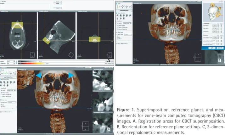 Figure 1. Superimposition, reference planes, and mea­
