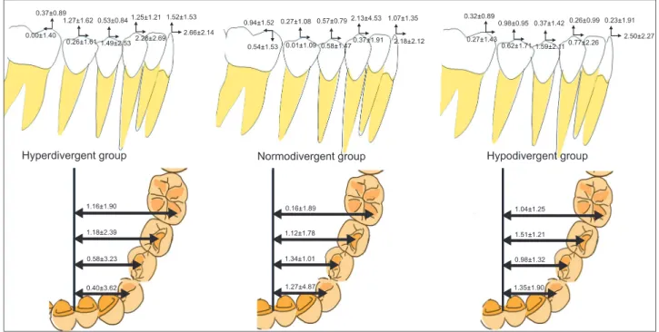 Figure 2. Tooth movement (mm) after dental decompensation according to vertical skeletal pattern