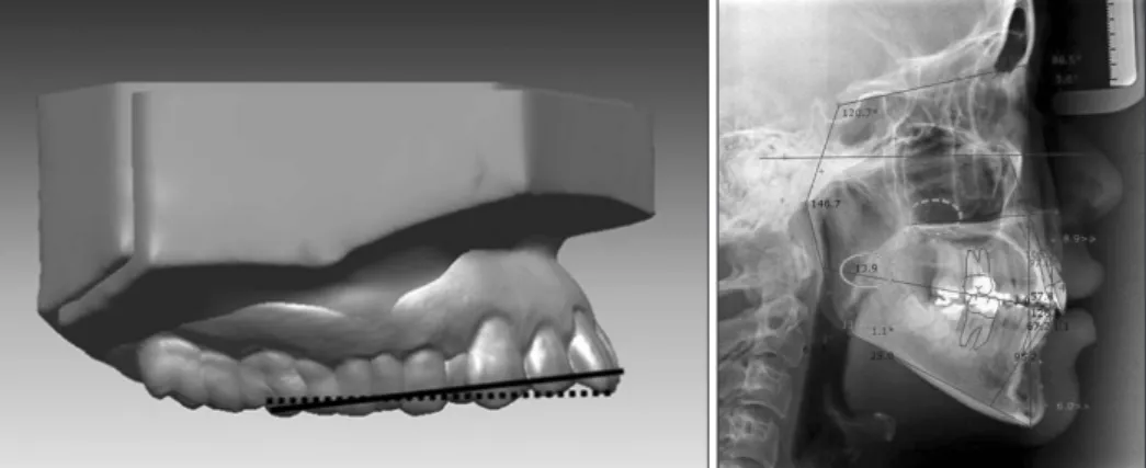 Figure 2. Verification of the superimposition accuracy of the three-dimensional virtual maxillary models (3D-VMXMs)
