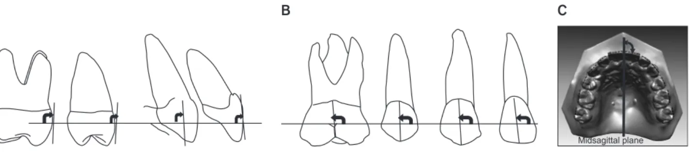Figure 7. Arch-dimension variables. IMXCW, Inter-maxillary canine width; IMXP2W, inter-maxillary second premolar  width; IMXM1W, inter-maxillary first molar width; IMXM2W, inter-maxillary second molar width; MXCD, maxillary  canine depth; MXMD, maxillary m