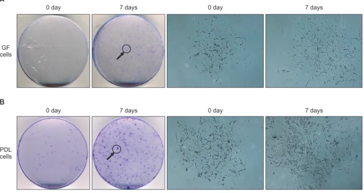 Figure 1. Cell culture colony-forming units (CFUs). At day 7 after plating, PDL cells were fixed with 10% formalin and  stained with 4% crystal violet