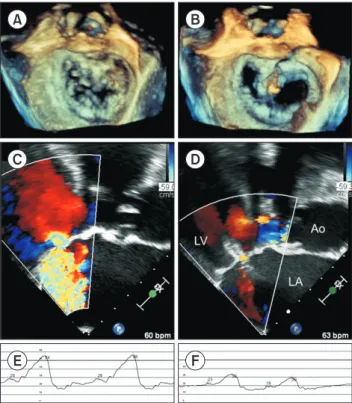 Fig. 2. Case example comparing before and after the procedure. 