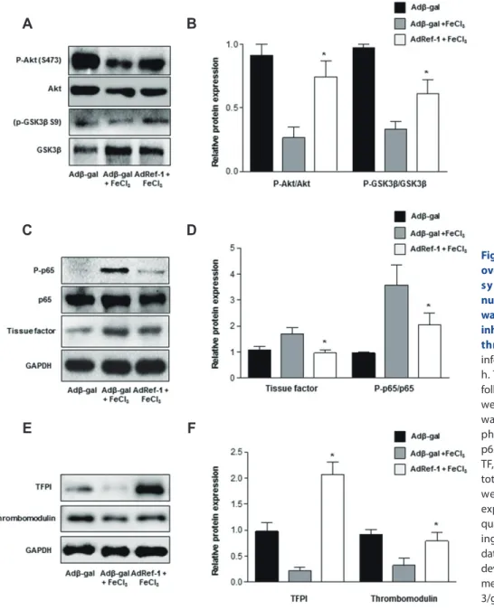 Fig. 2. Effect of redox factor-1 (Ref-1)  overexpression on the Akt/glycogen  synthase kinase 3 beta (GSK3β)/