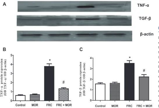 Fig. 4. Effect of morin on TNF-  and  TGF-  protein expressions in MBS rats.
