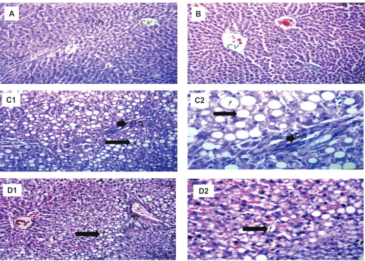 Fig. 5. Light microscopic examination of liver sections of normal control (A) and control morin (B) groups showing no histopathological al- al-teration and normal histological structure of the central vein (cv) and surrounding hepatocytes (h) (H&amp;E x40)