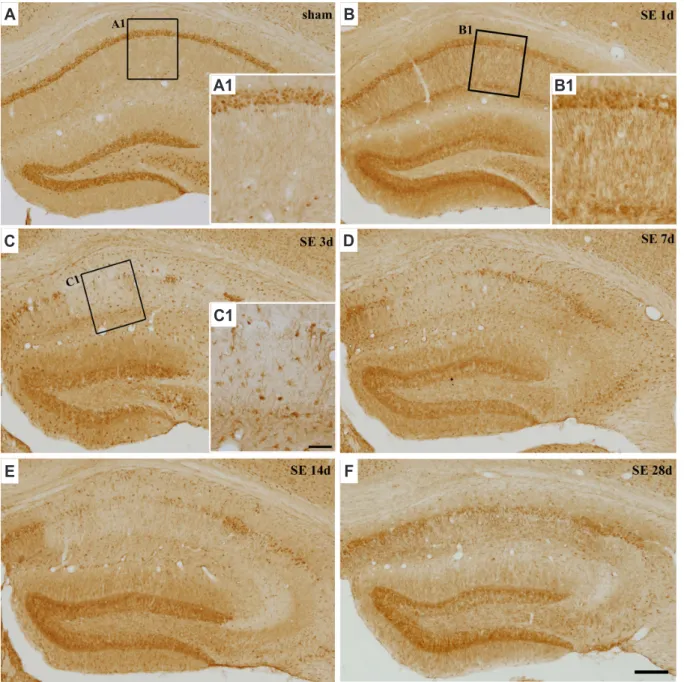 Fig. 2. Temporal expression pattern of regulator of calcineurin 1 (RCAN1) protein in the hippocampus after pilocarpine-induced status epi- epi-lepticus (SE)