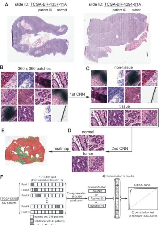 Fig. 1. Work flow of a fully automated tissue classifier for whole slide images (WSIs)
