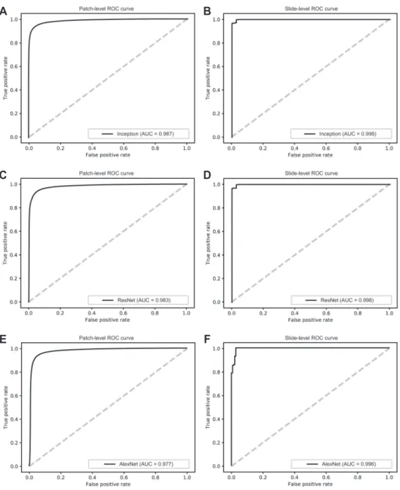 Fig. 2. Classification results for the three different networks on test sets. (A) Receiver operating characteristics (ROC) curve for the patch-level  classification with Inception-v3