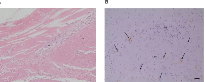 Fig. 1. ICC in the antrum of human stomach. Sections from paraffin-enbedded control samples stained with H&amp;E (A) and DOG-1 antibody (B)