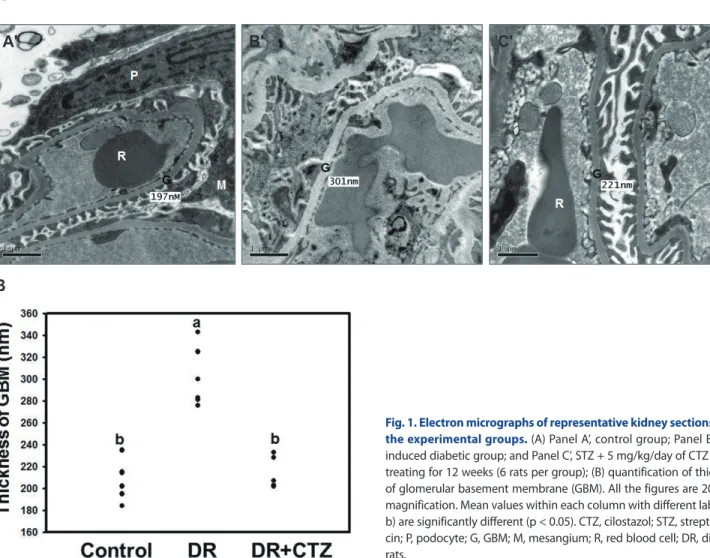 Fig. 1. Electron micrographs of representative kidney sections from  the experimental groups