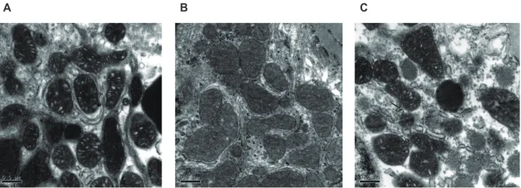 Fig. 2. Mitochondrion examination under electron micrographs of kidney sections. (A) control group, (B) STZ-induced diabetic group, (C) STZ + 5  mg/kg/day of CTZ group (6 rats per group)