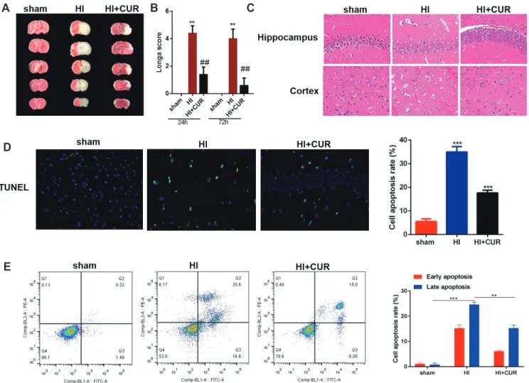 Table 1. Haemodynamic changes of rats in the sham, HI, and HI + CUR groups
