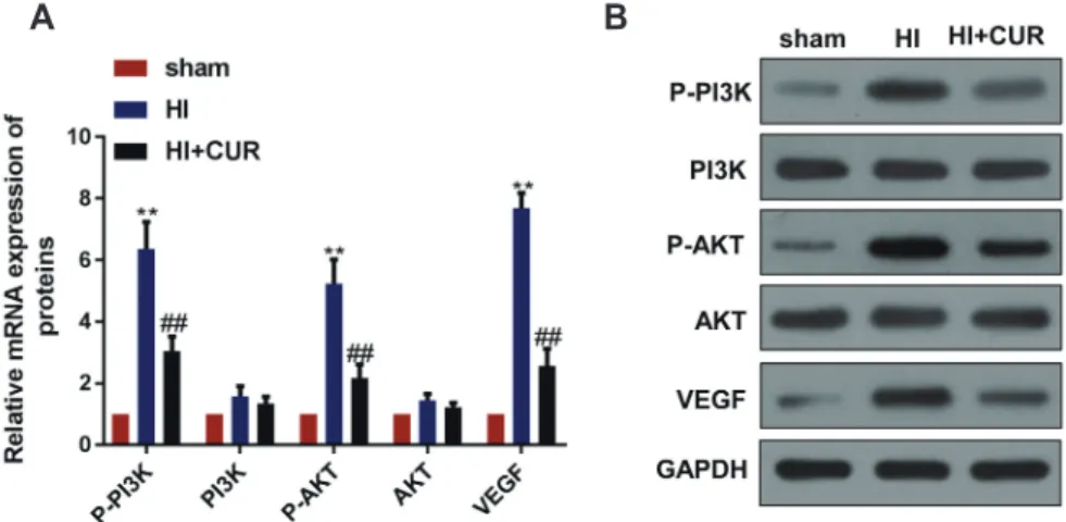 Fig. 2. Curcumin promotes the activation of PI3K/Akt signaling pathway and VEGF expression in neonatal rats with brain HI damage (n = 12  per group)