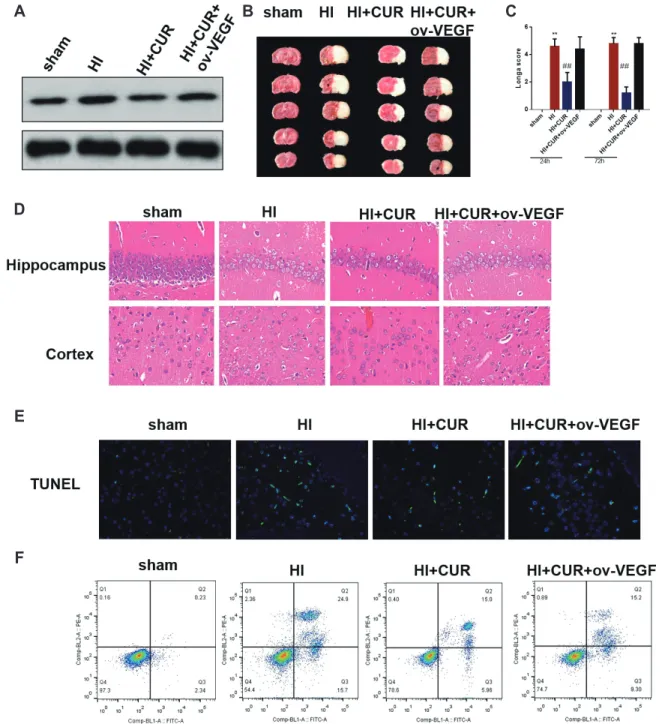 Fig. 4. The inhibitory effect of curcumin on brain HI damage is counteracted by VEGF overexpression in neonatal rats (n = 12 per group)