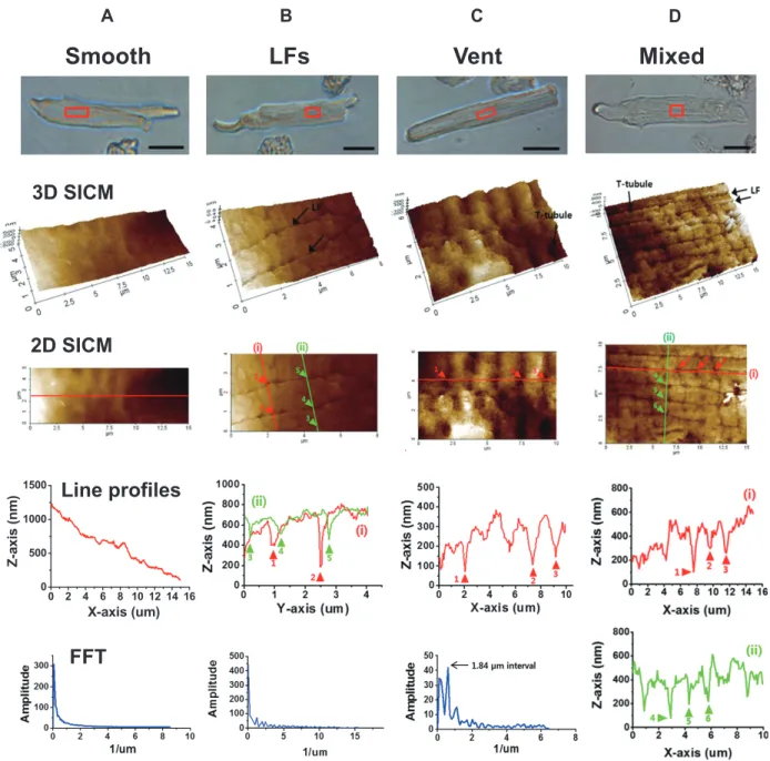 Fig. 3. Classification of rat atrial cell surface structure by scanning ion conductance microscopy (SICM) imaging