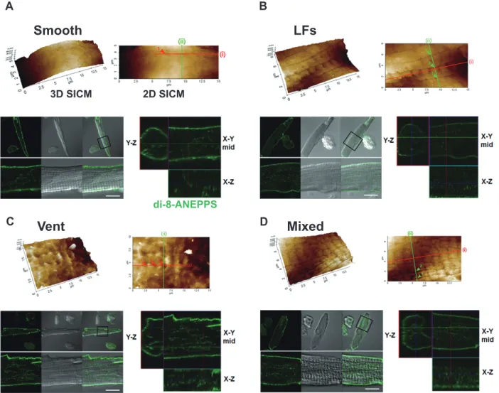 Fig. 3C shows a representative SICM image of the ventricular- ventricular-type cells. Like ventricular myocytes, ventricular-ventricular-type atrial cells  preserved well the Z-grooves and the crests