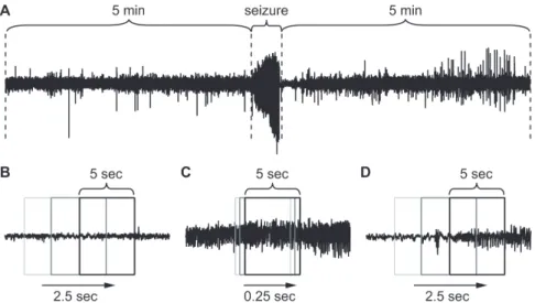 Fig. 1. Data set preparation for deep learning.  (A) Non-seizure data were obtained from 5 min of electroencephalogram (EEG) before and after each  seizure