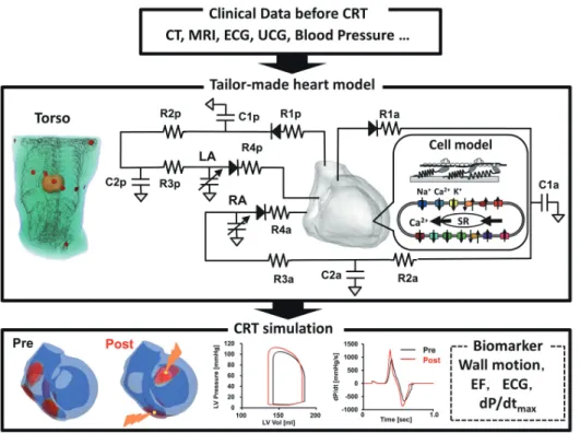 Fig. 2. Custom-made cardiac resyn- resyn-chronization therapy (CRT)  simula-tion. Patient-specific multiscale models  of the heart and torso were created  according to clinical data that were  ob-tained before CRT (development step)