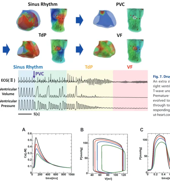 Fig. 7. Drug-induced fatal arrhythmia. 