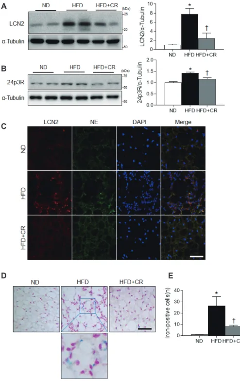 Fig. 2. Effects of caloric restriction (CR)  on lipocalin 2 (LCN2), 24p3R  expres-sion, and iron accumulation in the  brown adipose tissue (BAT) of  high-fat diet (HFD)-fed mice