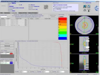 Fig. 4. Profile of point dose with scintillation screen for obtaining blurring kernel (k).