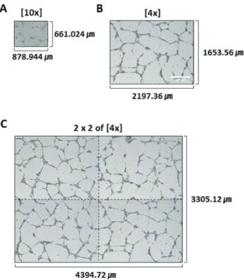 Fig. 2. Progression of tube formation  from human endothelial colony  form-ing cells (ECFCs)
