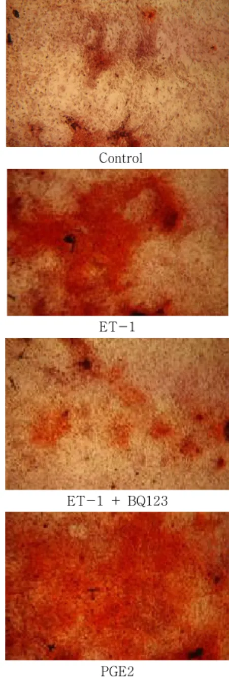 Fig. 3. Mineralized matrix formation by osteoblasts.