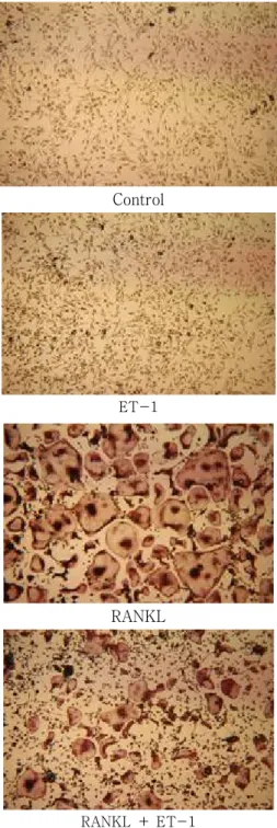 Fig. 6. Tartrate-resistant acid phosphatase (TRAP) staining showing osteoclastogenesis